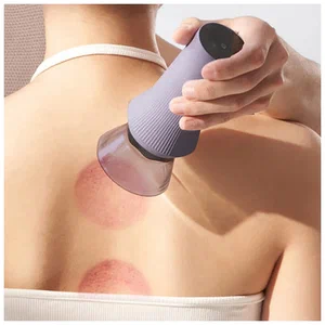 Вакуумный массажер Xiaomi Smart Bianstone Scraping Massager Gray (ZD-GS328) в Челябинске купить по недорогим ценам с доставкой